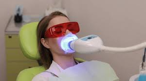 Diş beyazlatma uygulaması